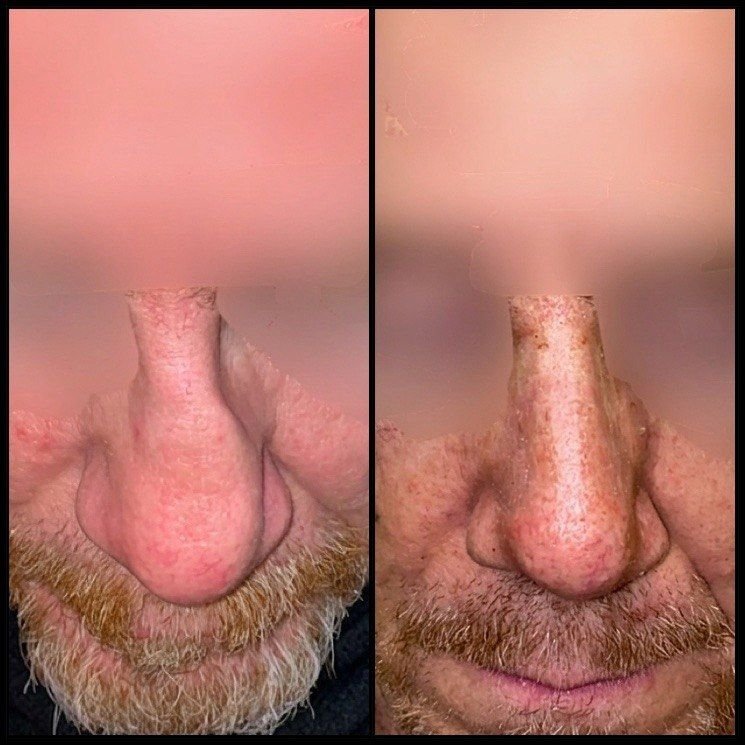 Risultato volto prima e dopo